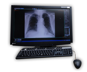 デジタルX線 画像診断システム